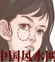 澄迈脸上这些地方有痣，不利财运，一生难发大财